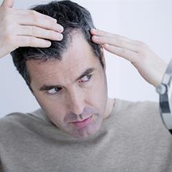 ۱۰ توصیه به آقایان برای مراقبت از مو و درمان ریزش مو